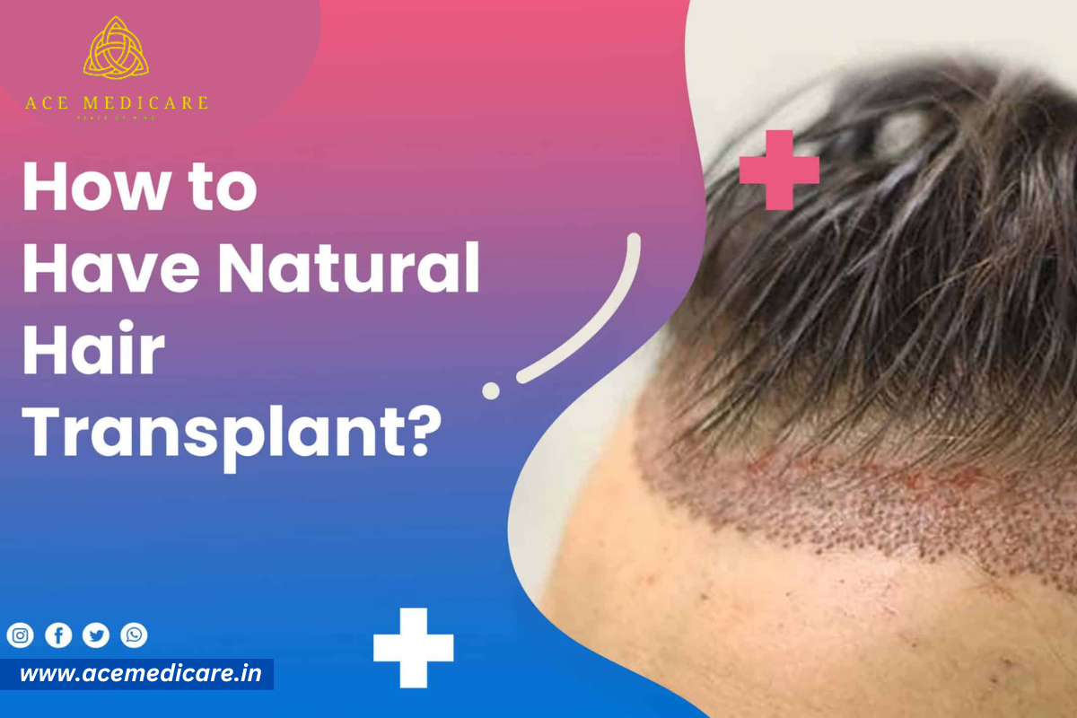 Achieve Natural-Looking Hair with a Hair Transplant Procedure